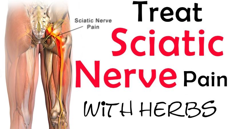 Treat Sciatica Pain With Herbs