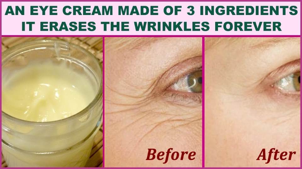 An Eye Cream Made of 3 Ingredients That Will Make You Feel 5 Years Younger: It Erases the Wrinkles Like With a Rubber!