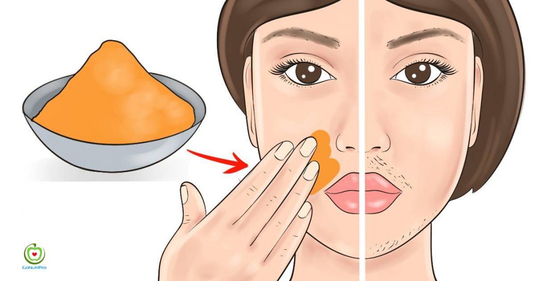 Remove Facial Hair Easily With These Natural Remedies