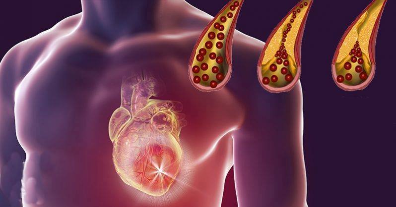 Foods That You Should Eat Daily For Clean Arteries