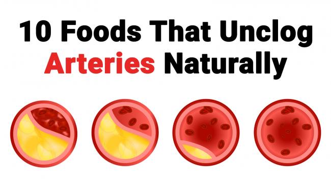 Foods That Unclog Arteries