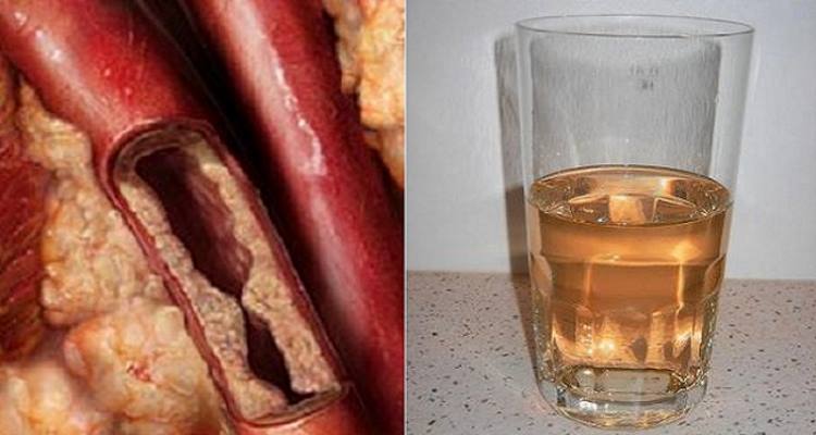 A Simple Drink Will Unclog Arteries