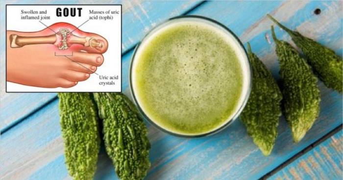 STOP Gout And Joint Pain